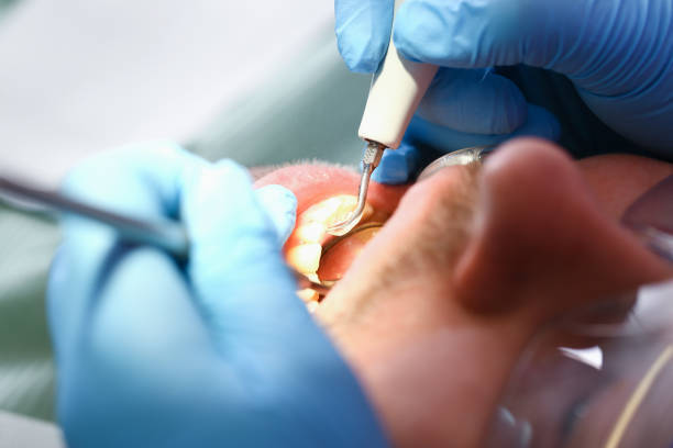 Best Emergency Dental Care for Broken or Chipped Teeth in Elroy, NC