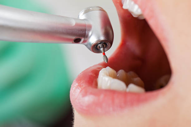 Best Emergency Treatment for Dental Infections or Abscesses in Elroy, NC